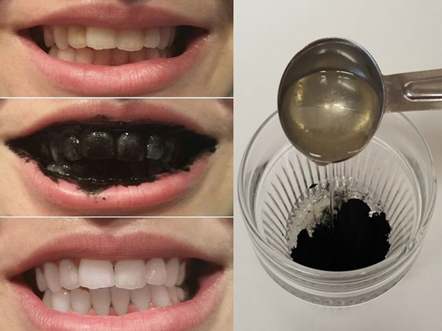 cách dùng than hoạt tính làm đẹp răng